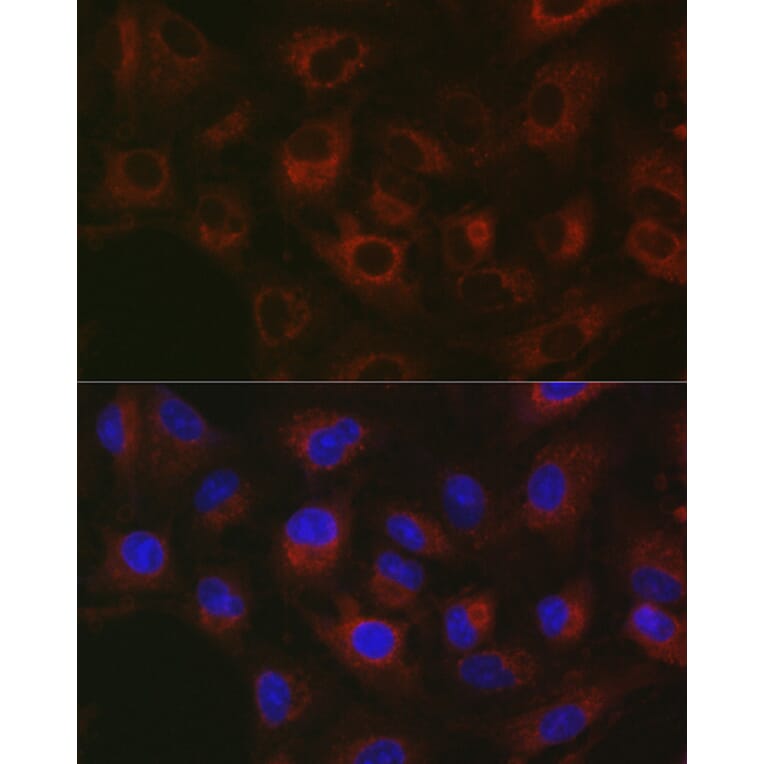 Immunofluorescence - Anti-GPI-PLD Antibody (A15299) - Antibodies.com