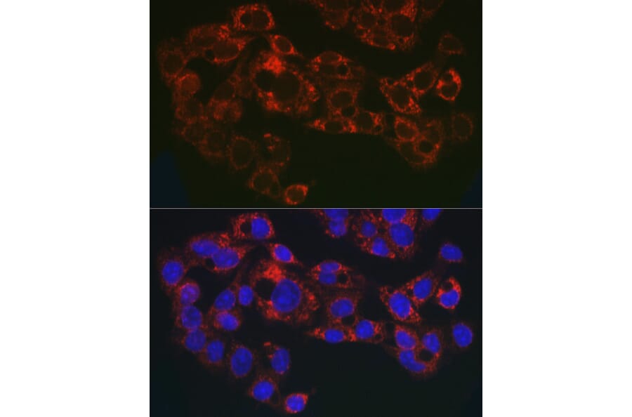 Immunofluorescence - Anti-GPI-PLD Antibody (A15299) - Antibodies.com