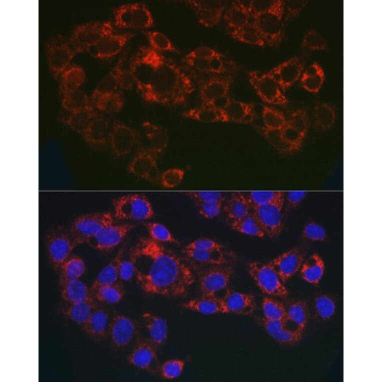 Immunofluorescence - Anti-GPI-PLD Antibody (A15299) - Antibodies.com