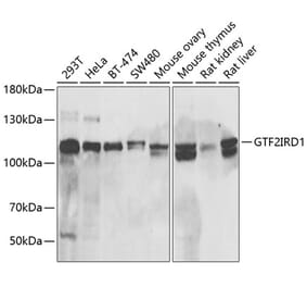 Western Blot - Anti-GTF2IRD1 Antibody (A15300) - Antibodies.com