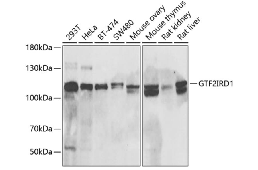 Western Blot - Anti-GTF2IRD1 Antibody (A15300) - Antibodies.com