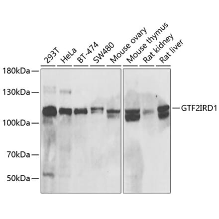 Western Blot - Anti-GTF2IRD1 Antibody (A15300) - Antibodies.com