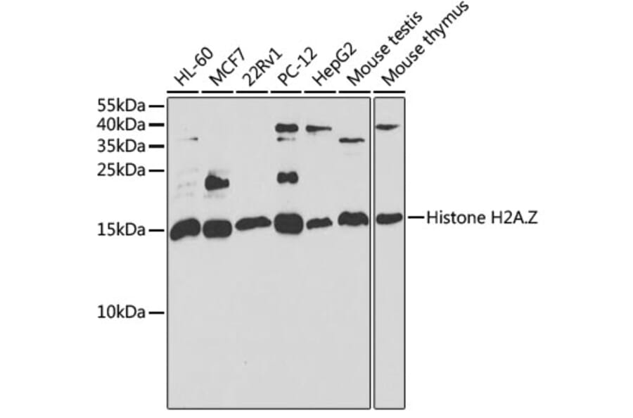 Western Blot - Anti-Histone H2A.Z Antibody (A15301) - Antibodies.com