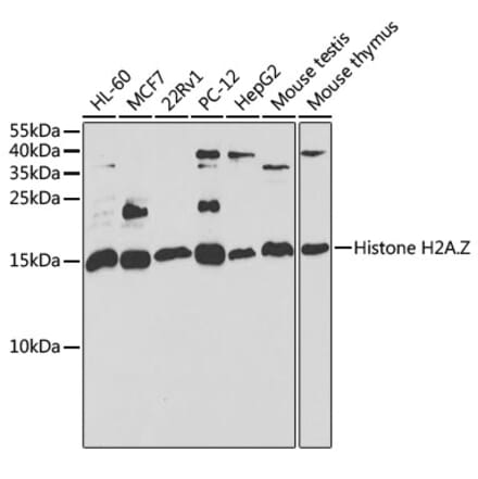 Western Blot - Anti-Histone H2A.Z Antibody (A15301) - Antibodies.com