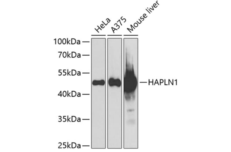Western Blot - Anti-HAPLN1 Antibody (A15302) - Antibodies.com