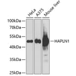 Western Blot - Anti-HAPLN1 Antibody (A15302) - Antibodies.com