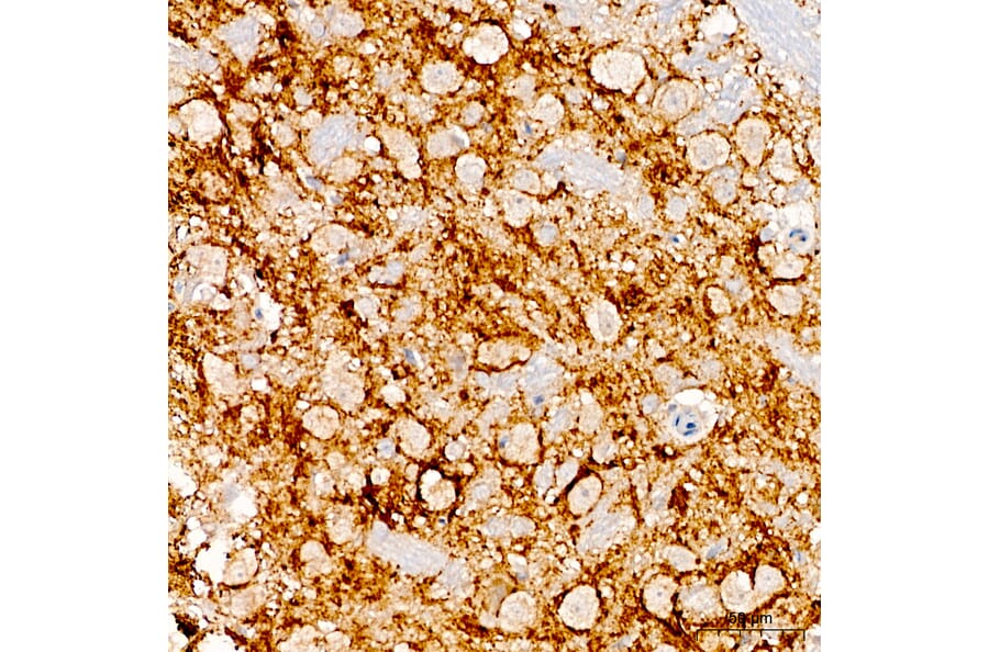 Immunohistochemistry - Anti-HAPLN1 Antibody (A15302) - Antibodies.com
