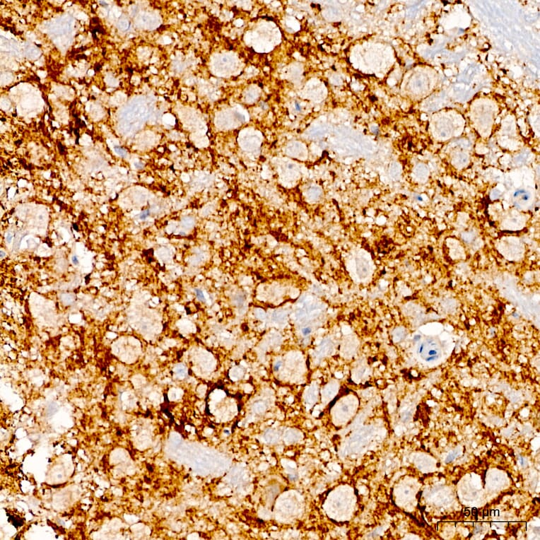 Immunohistochemistry - Anti-HAPLN1 Antibody (A15302) - Antibodies.com
