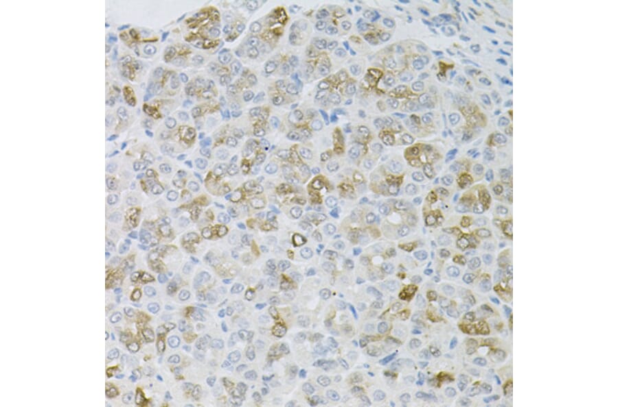 Immunohistochemistry - Anti-HPS1 Antibody (A6621) - Antibodies.com