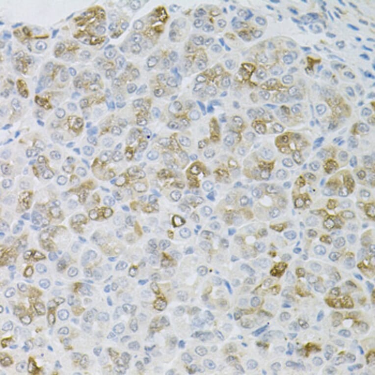 Immunohistochemistry - Anti-HPS1 Antibody (A6621) - Antibodies.com