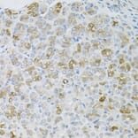Immunohistochemistry - Anti-HPS1 Antibody (A6621) - Antibodies.com