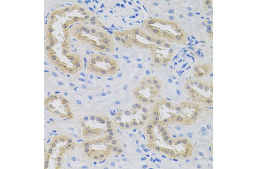 Immunohistochemistry - Anti-HPS1 Antibody (A6621) - Antibodies.com