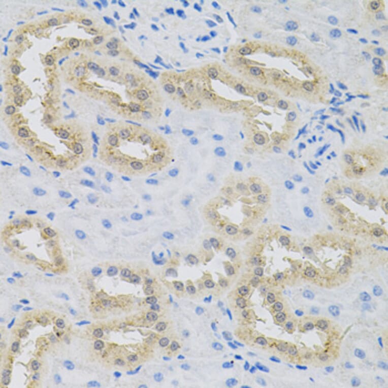 Immunohistochemistry - Anti-HPS1 Antibody (A6621) - Antibodies.com