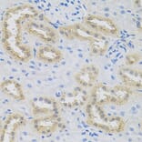 Immunohistochemistry - Anti-HPS1 Antibody (A6621) - Antibodies.com