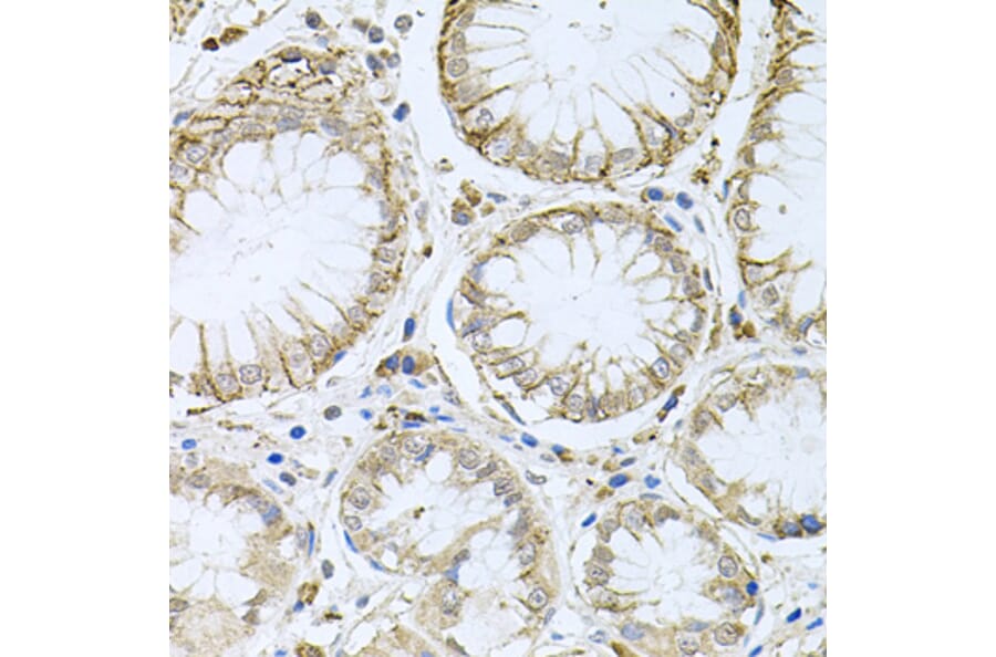 Immunohistochemistry - Anti-HPS1 Antibody (A6621) - Antibodies.com