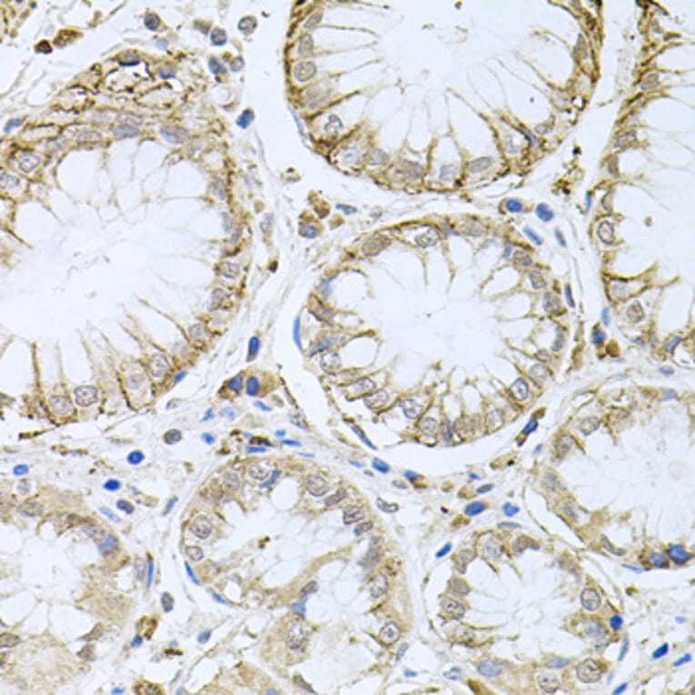 Immunohistochemistry - Anti-HPS1 Antibody (A6621) - Antibodies.com