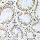 Immunohistochemistry - Anti-HPS1 Antibody (A6621) - Antibodies.com