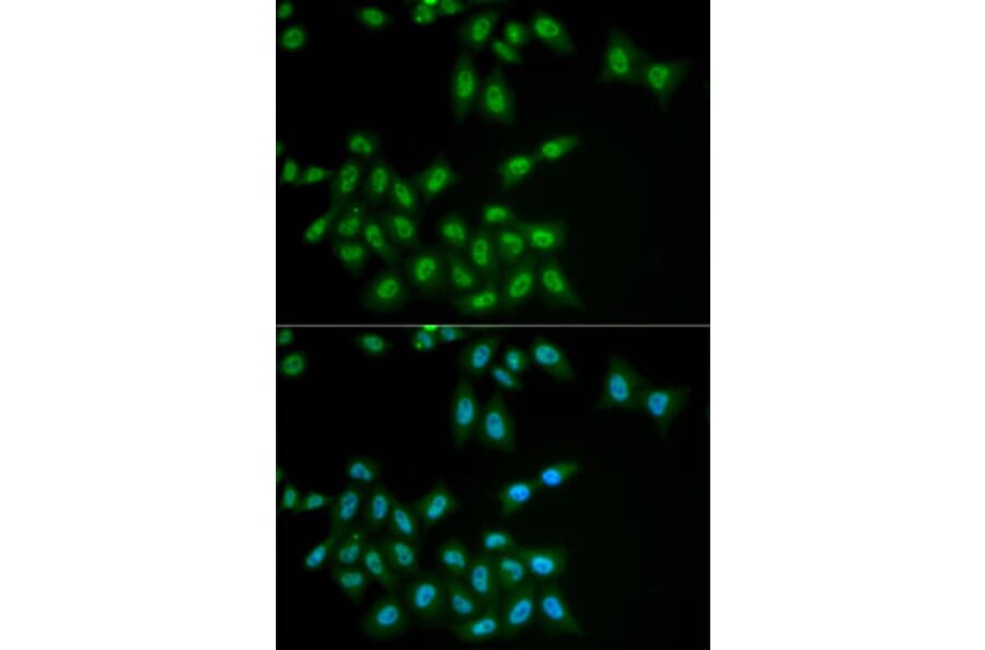 Immunofluorescence - Anti-HPS1 Antibody (A6621) - Antibodies.com