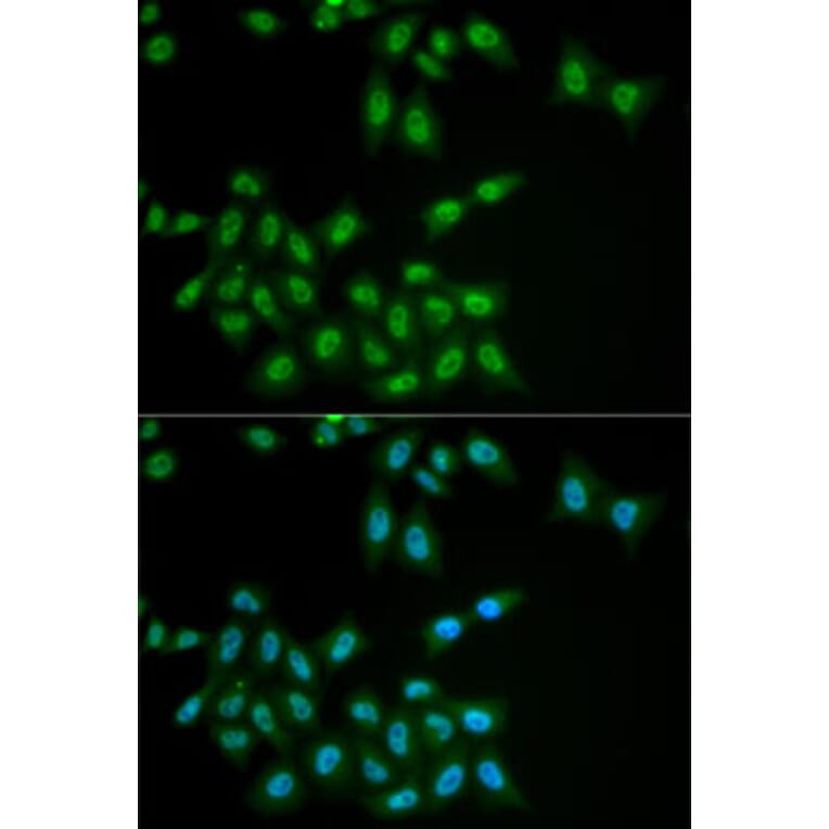 Immunofluorescence - Anti-HPS1 Antibody (A6621) - Antibodies.com