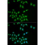 Immunofluorescence - Anti-HPS1 Antibody (A6621) - Antibodies.com