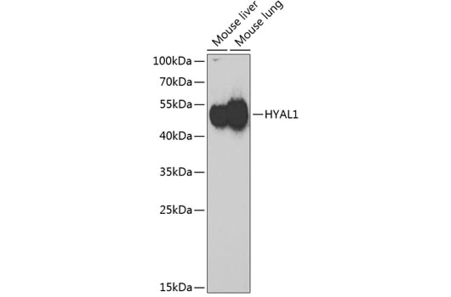 Western Blot - Anti-HYAL1 Antibody (A6623) - Antibodies.com