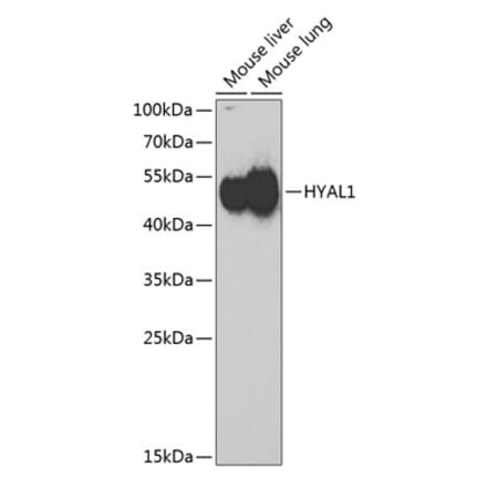 Western Blot - Anti-HYAL1 Antibody (A6623) - Antibodies.com