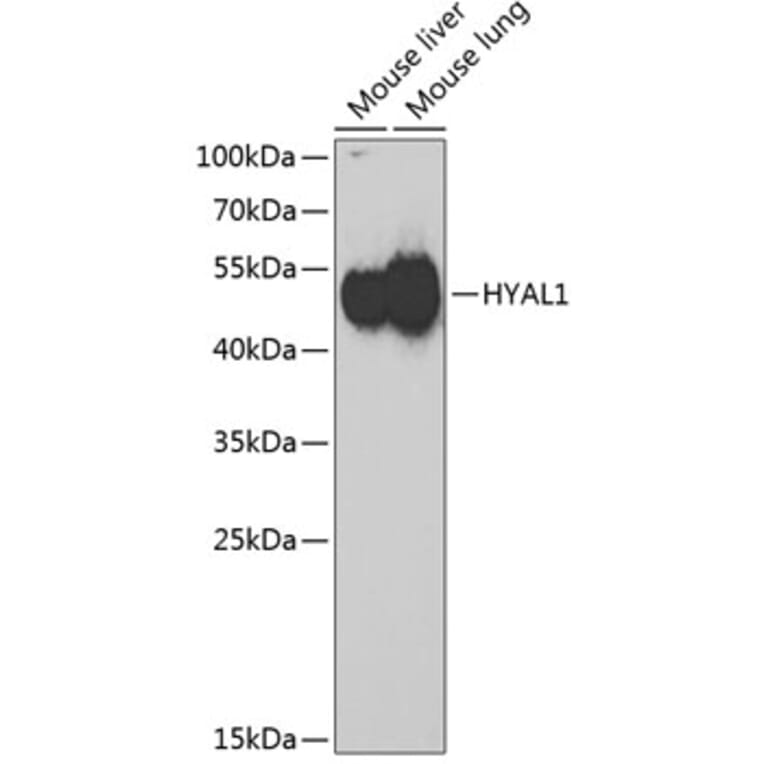 Western Blot - Anti-HYAL1 Antibody (A6623) - Antibodies.com