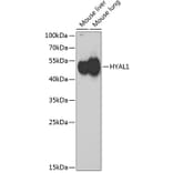 Western Blot - Anti-HYAL1 Antibody (A6623) - Antibodies.com