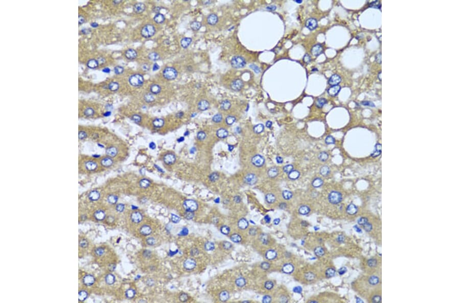 Immunohistochemistry - Anti-HYAL1 Antibody (A6623) - Antibodies.com