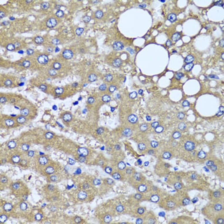 Immunohistochemistry - Anti-HYAL1 Antibody (A6623) - Antibodies.com