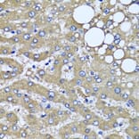 Immunohistochemistry - Anti-HYAL1 Antibody (A6623) - Antibodies.com