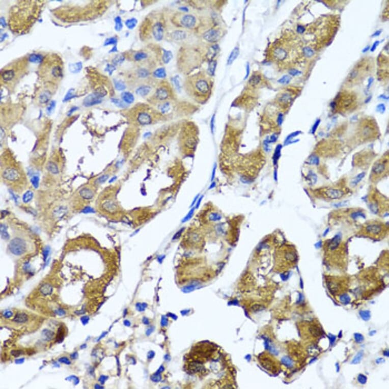 Immunohistochemistry - Anti-HYAL1 Antibody (A6623) - Antibodies.com