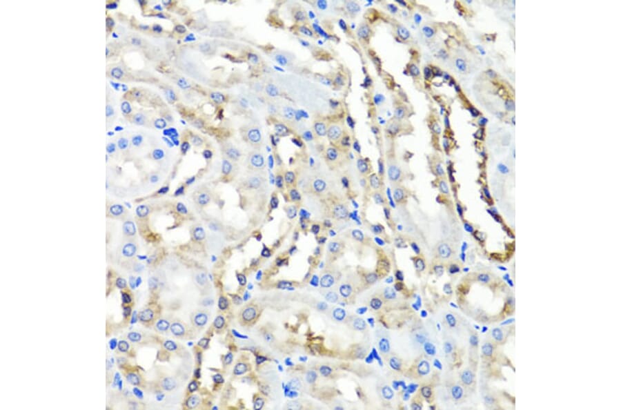 Immunohistochemistry - Anti-HYAL1 Antibody (A6623) - Antibodies.com