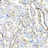 Immunohistochemistry - Anti-HYAL1 Antibody (A6623) - Antibodies.com