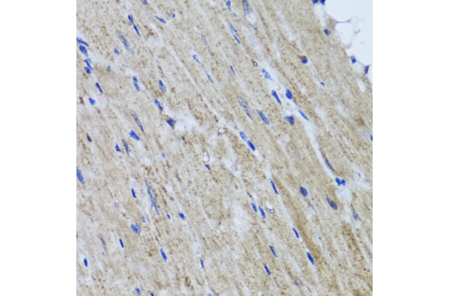 Immunohistochemistry - Anti-HYAL1 Antibody (A6623) - Antibodies.com