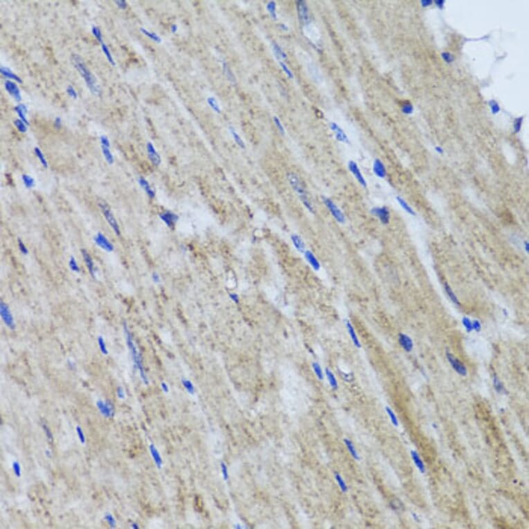 Immunohistochemistry - Anti-HYAL1 Antibody (A6623) - Antibodies.com