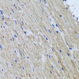 Immunohistochemistry - Anti-HYAL1 Antibody (A6623) - Antibodies.com