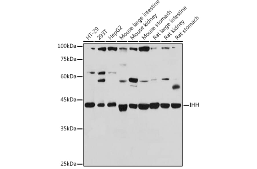 Western Blot - Anti-Ihh Antibody (A15305) - Antibodies.com