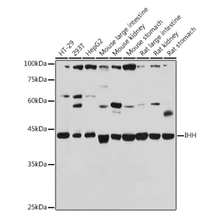 Western Blot - Anti-Ihh Antibody (A15305) - Antibodies.com