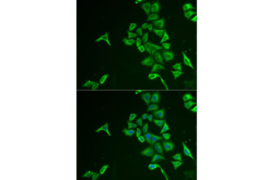 Immunofluorescence - Anti-INPP5J Antibody (A15306) - Antibodies.com