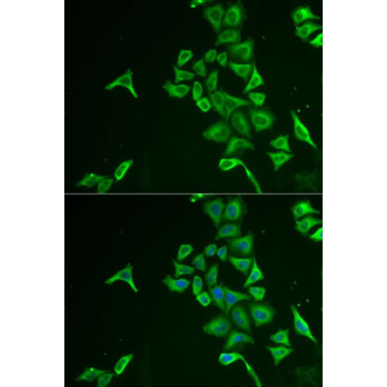 Immunofluorescence - Anti-INPP5J Antibody (A15306) - Antibodies.com