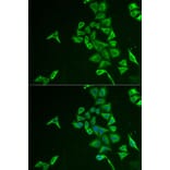 Immunofluorescence - Anti-INPP5J Antibody (A15306) - Antibodies.com