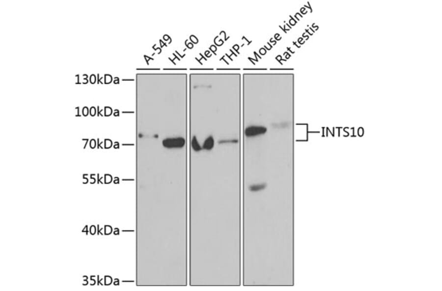 Western Blot - Anti-INTS10 Antibody (A15307) - Antibodies.com