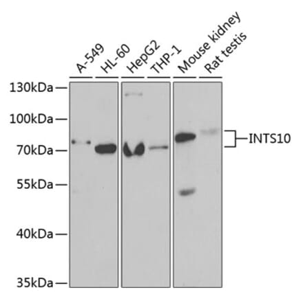 Western Blot - Anti-INTS10 Antibody (A15307) - Antibodies.com