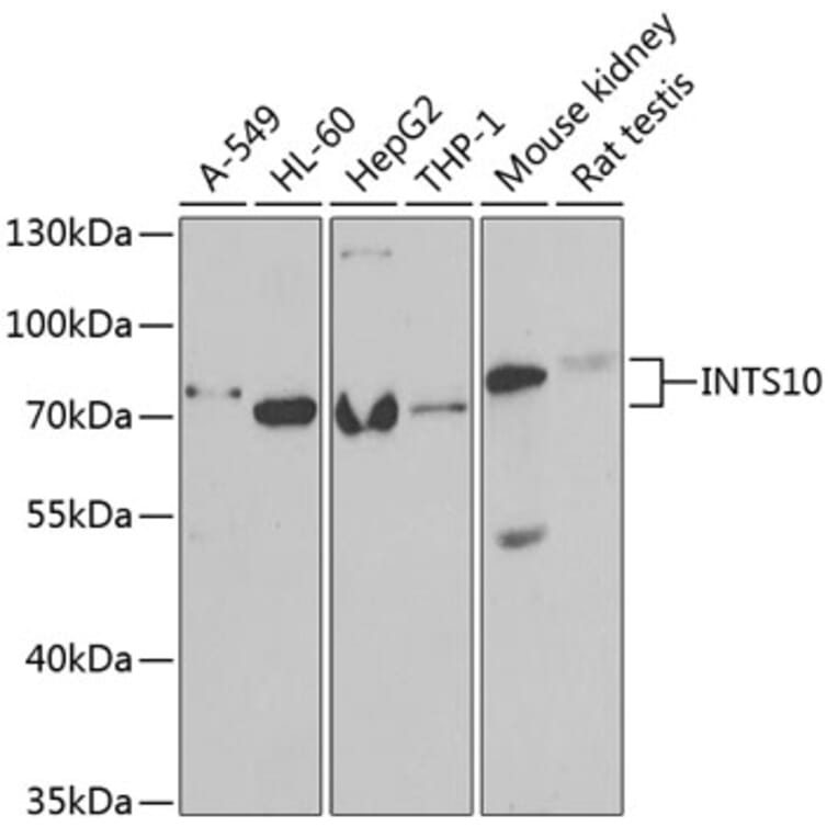 Western Blot - Anti-INTS10 Antibody (A15307) - Antibodies.com