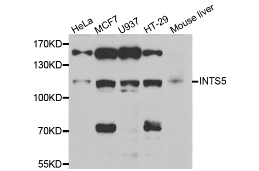 Western Blot - Anti-INTS5 Antibody (A6633) - Antibodies.com