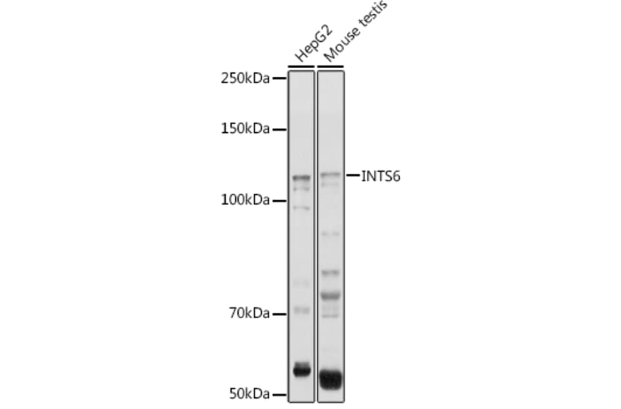 Western Blot - Anti-INTS6 Antibody (A15309) - Antibodies.com
