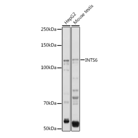 Western Blot - Anti-INTS6 Antibody (A15309) - Antibodies.com