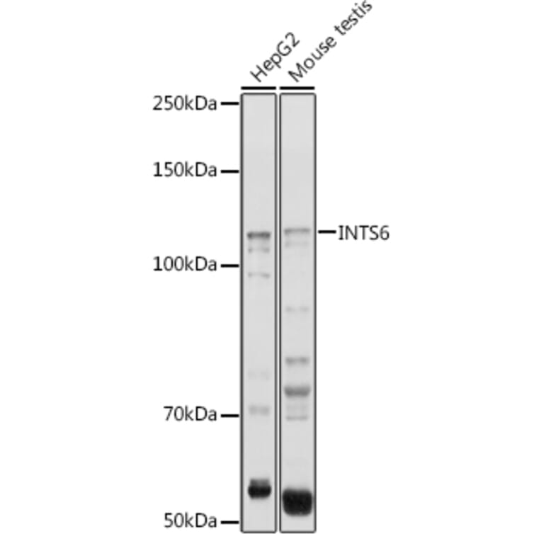 Western Blot - Anti-INTS6 Antibody (A15309) - Antibodies.com