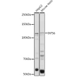 Western Blot - Anti-INTS6 Antibody (A15309) - Antibodies.com